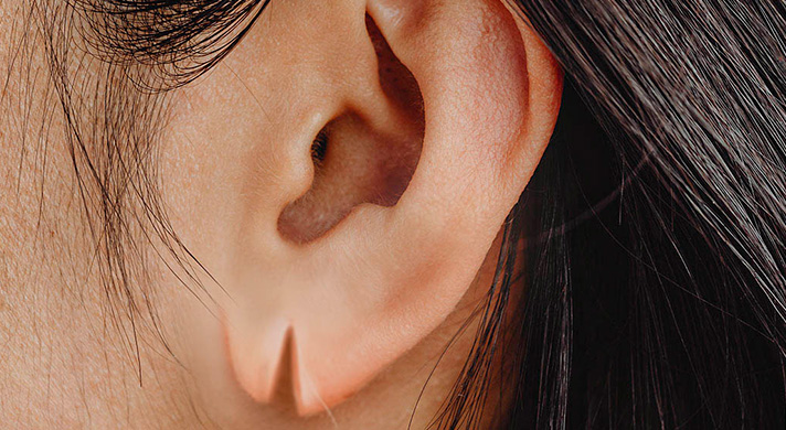 Correções de lóbulo de orelha - Imagem Ilustrativa