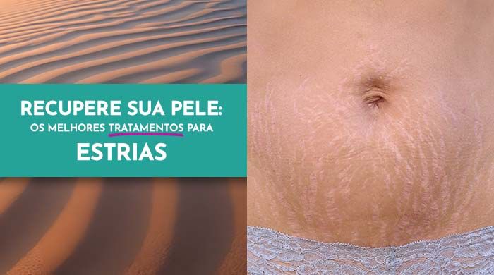 A imagem mostra duas imagens, do lado direito uma barriga com estrias e ao lado esquerdo uma região de areia onduladas