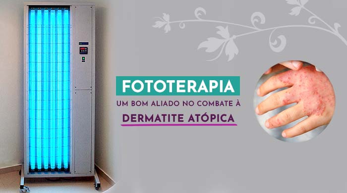 A imagem mostra uma máquina de fototerapia e ao lado uma mão com dermatite atópica