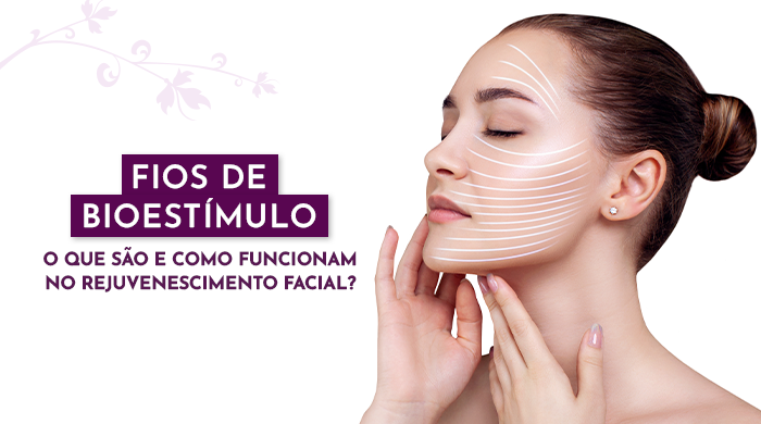 Mulher com expressão relaxada, cabelos presos e linhas brancas desenhadas no rosto, ilustrando áreas de rejuvenescimento facial e bioestimulação.