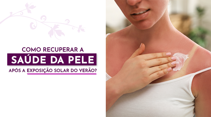 Pessoa com queimadura solar aplicando creme hidratante no ombro avermelhado, aliviando os efeitos da exposição excessiva ao sol.