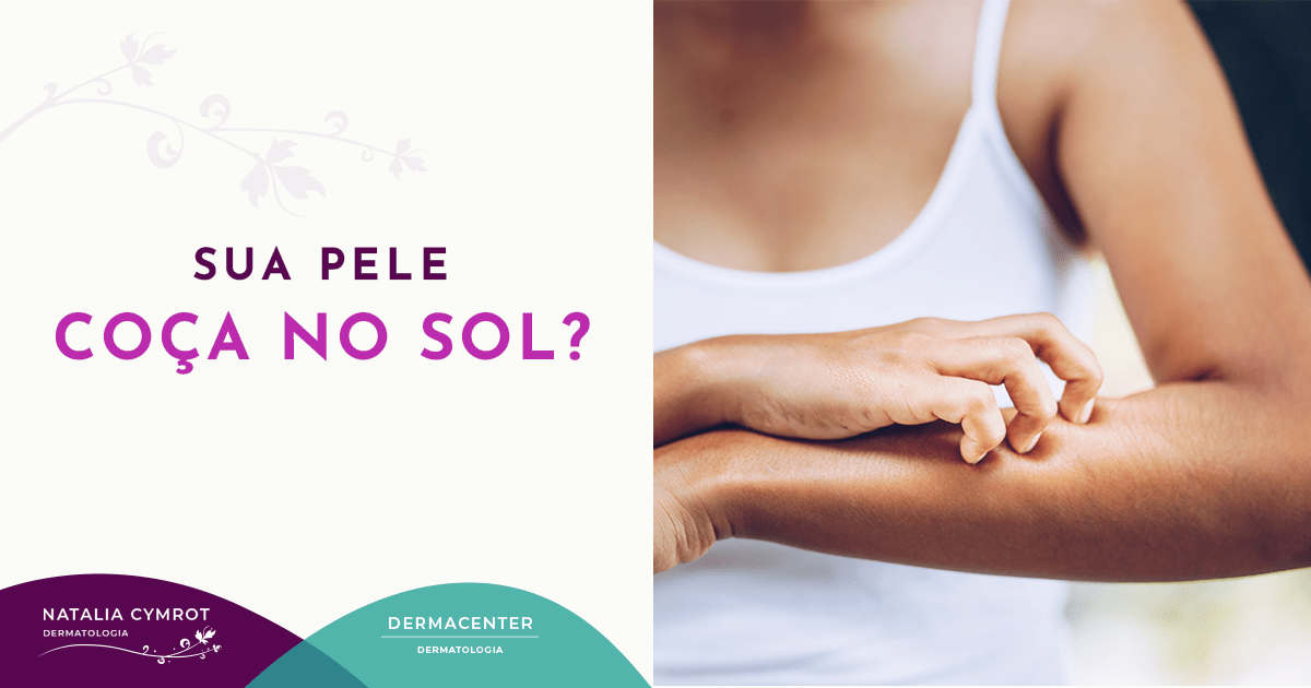 Sua pele coça no sol? - Clínica Natalia Cymrot & Clínica Dermacenter