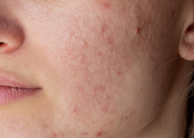 transformation-img-1