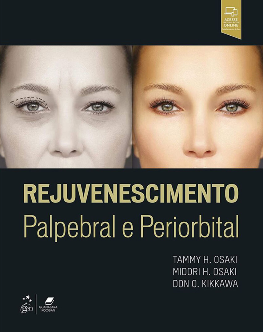 Rejuvenescimento Palpebral e Periorbital