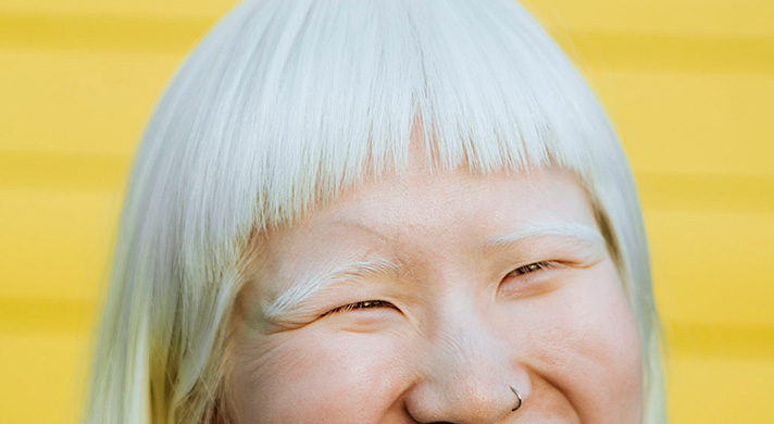 Especialista em Doenças de Pele de Nascença em São Paulo