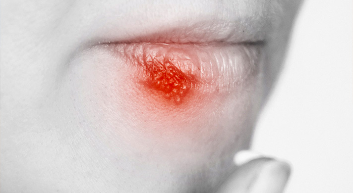 dermatologista de infecção de pele em são paulo