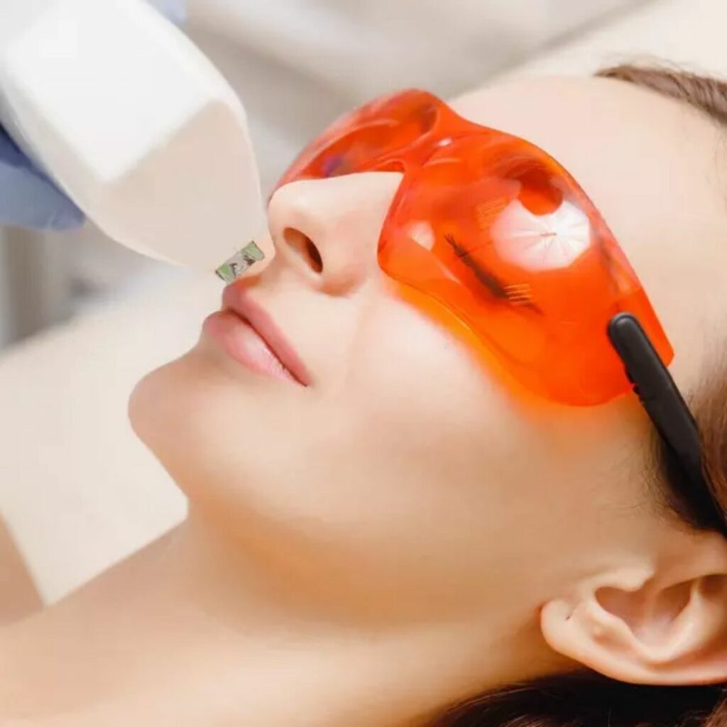 tratamentos estéticos e a laser