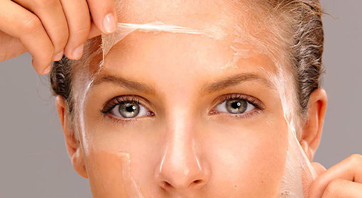 Peelings Químicos em São Paulo