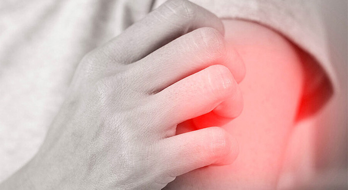 Tratamento para Urticária em São Paulo