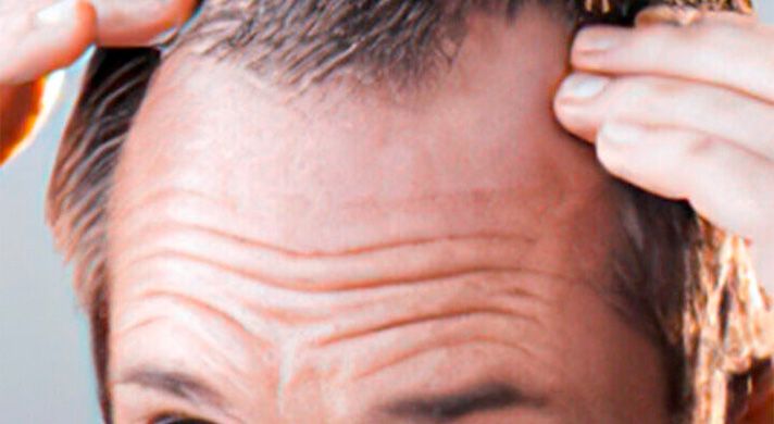 tratamento capilar em são paulo